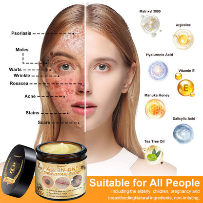 [𝐌𝐚𝐠𝐚𝐬𝐢𝐧 𝐨𝐟𝐟𝐢𝐜𝐢𝐞𝐥 𝐝𝐞 𝐥𝐚 𝐦𝐚𝐫𝐪𝐮𝐞✨ 𝐋𝐞𝐧𝐚𝐫𝐨™ Crème polyvalente au venin d'abeille (👩‍⚕️ Produit recommandé spécialement 2025)]