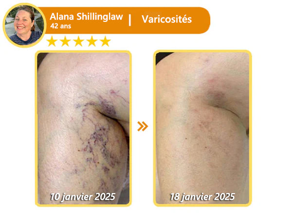 [𝐌𝐚𝐠𝐚𝐬𝐢𝐧 𝐨𝐟𝐟𝐢𝐜𝐢𝐞𝐥 𝐝𝐞 𝐥𝐚 𝐦𝐚𝐫𝐪𝐮𝐞🕶️ 𝐋𝐞𝐧𝐚𝐫𝐨™ Crème polyvalente au venin d'abeille (👩‍⚕️ Produit recommandé spécialement 2025)]