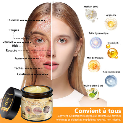 [𝐌𝐚𝐠𝐚𝐬𝐢𝐧 𝐨𝐟𝐟𝐢𝐜𝐢𝐞𝐥 𝐝𝐞 𝐥𝐚 𝐦𝐚𝐫𝐪𝐮𝐞🕶️ 𝐋𝐞𝐧𝐚𝐫𝐨™ Crème polyvalente au venin d'abeille (👩‍⚕️ Produit recommandé spécialement 2025)]