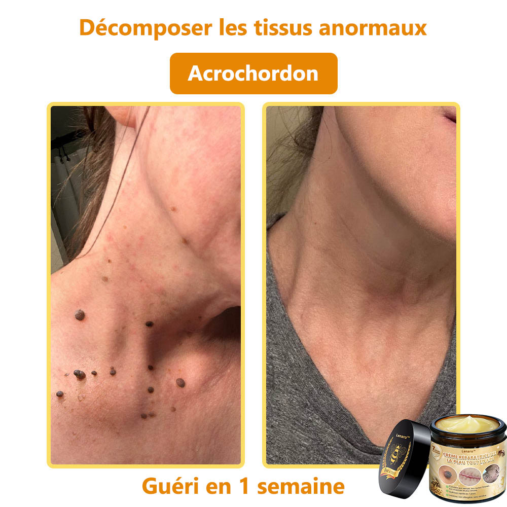 [𝐌𝐚𝐠𝐚𝐬𝐢𝐧 𝐨𝐟𝐟𝐢𝐜𝐢𝐞𝐥 𝐝𝐞 𝐥𝐚 𝐦𝐚𝐫𝐪𝐮𝐞🕶️ 𝐋𝐞𝐧𝐚𝐫𝐨™ Crème polyvalente au venin d'abeille (👩‍⚕️ Produit recommandé spécialement 2025)]