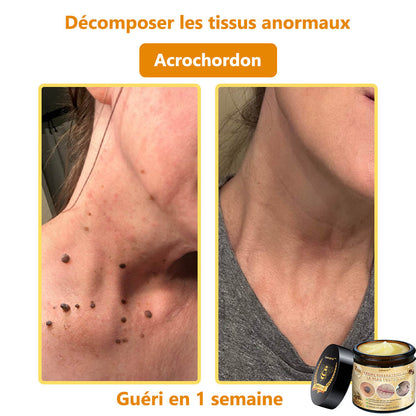 [𝐌𝐚𝐠𝐚𝐬𝐢𝐧 𝐨𝐟𝐟𝐢𝐜𝐢𝐞𝐥 𝐝𝐞 𝐥𝐚 𝐦𝐚𝐫𝐪𝐮𝐞🕶️ 𝐋𝐞𝐧𝐚𝐫𝐨™ Crème polyvalente au venin d'abeille (👩‍⚕️ Produit recommandé spécialement 2025)]