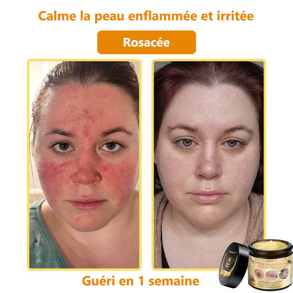 [𝐌𝐚𝐠𝐚𝐬𝐢𝐧 𝐨𝐟𝐟𝐢𝐜𝐢𝐞𝐥 𝐝𝐞 𝐥𝐚 𝐦𝐚𝐫𝐪𝐮𝐞🕶️ 𝐋𝐞𝐧𝐚𝐫𝐨™ Crème polyvalente au venin d'abeille (👩‍⚕️ Produit recommandé spécialement 2025)]