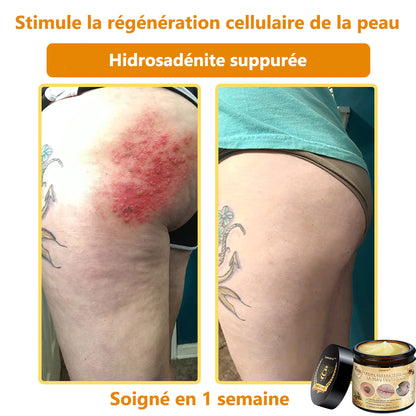 [𝐌𝐚𝐠𝐚𝐬𝐢𝐧 𝐨𝐟𝐟𝐢𝐜𝐢𝐞𝐥 𝐝𝐞 𝐥𝐚 𝐦𝐚𝐫𝐪𝐮𝐞🕶️ 𝐋𝐞𝐧𝐚𝐫𝐨™ Crème polyvalente au venin d'abeille (👩‍⚕️ Produit recommandé spécialement 2025)]