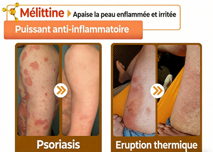 [𝐌𝐚𝐠𝐚𝐬𝐢𝐧 𝐨𝐟𝐟𝐢𝐜𝐢𝐞𝐥 𝐝𝐞 𝐥𝐚 𝐦𝐚𝐫𝐪𝐮𝐞🕶️ 𝐋𝐞𝐧𝐚𝐫𝐨™ Crème polyvalente au venin d'abeille (👩‍⚕️ Produit recommandé spécialement 2025)]
